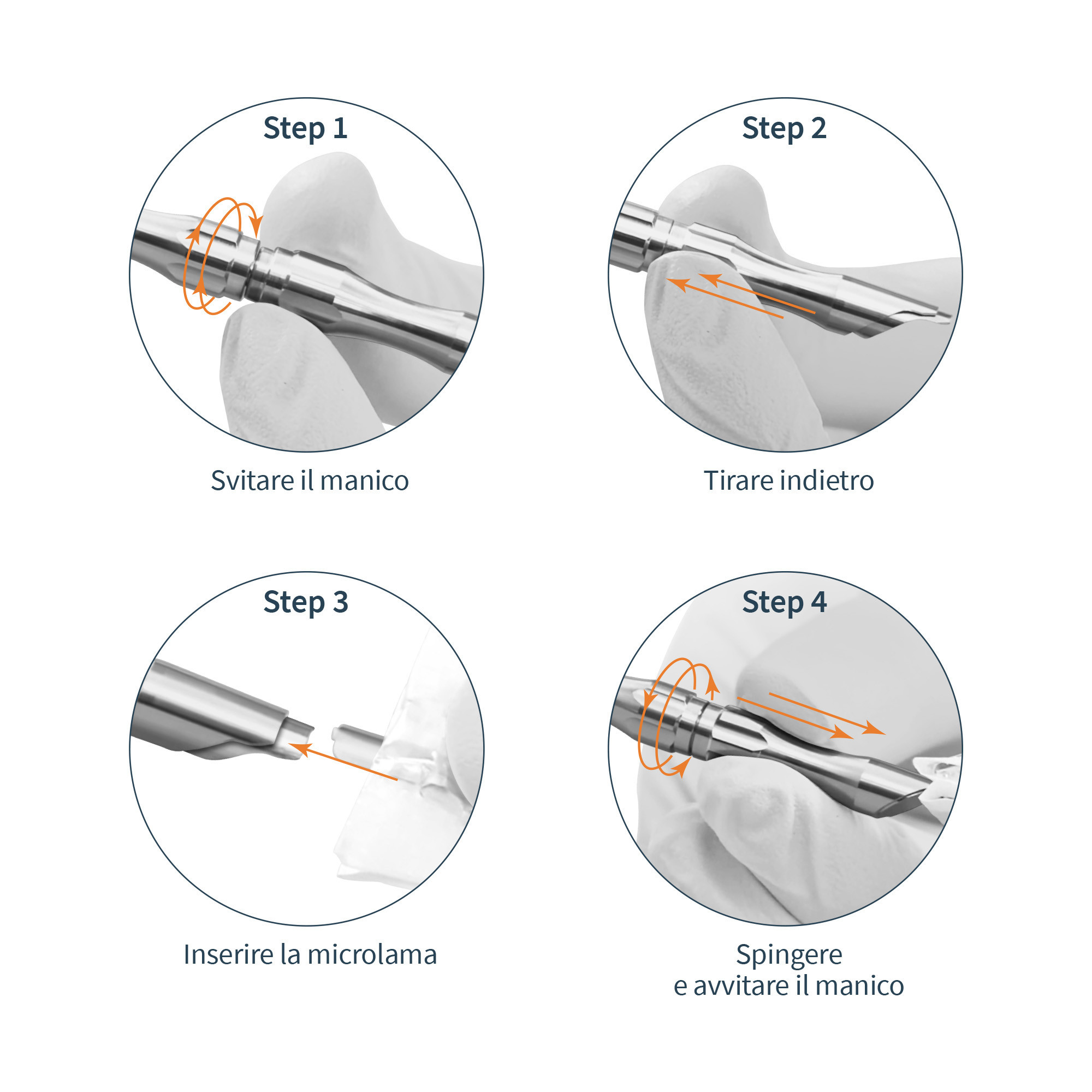 Universal aluminium handle for Tecniwork micro-blades sizes 2-2,5-3