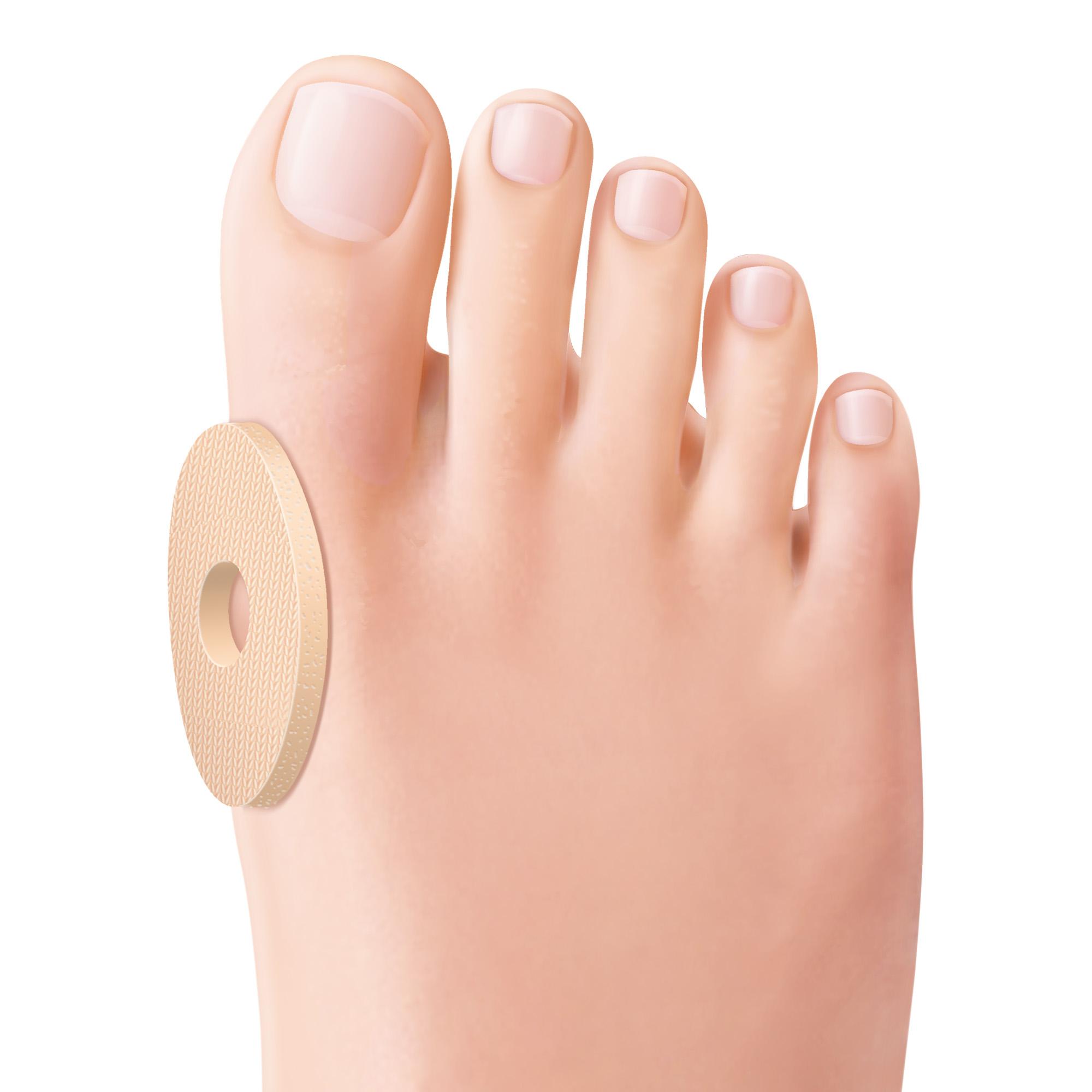 Protections pour callosités dures du pied, lot de 9 pièces