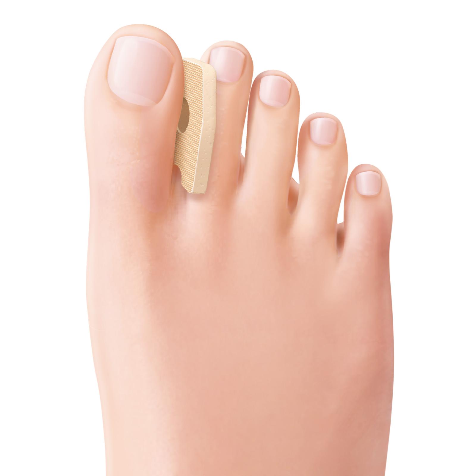 Protective pads for interdigital calluses and soft corns on the toes (9 pcs)