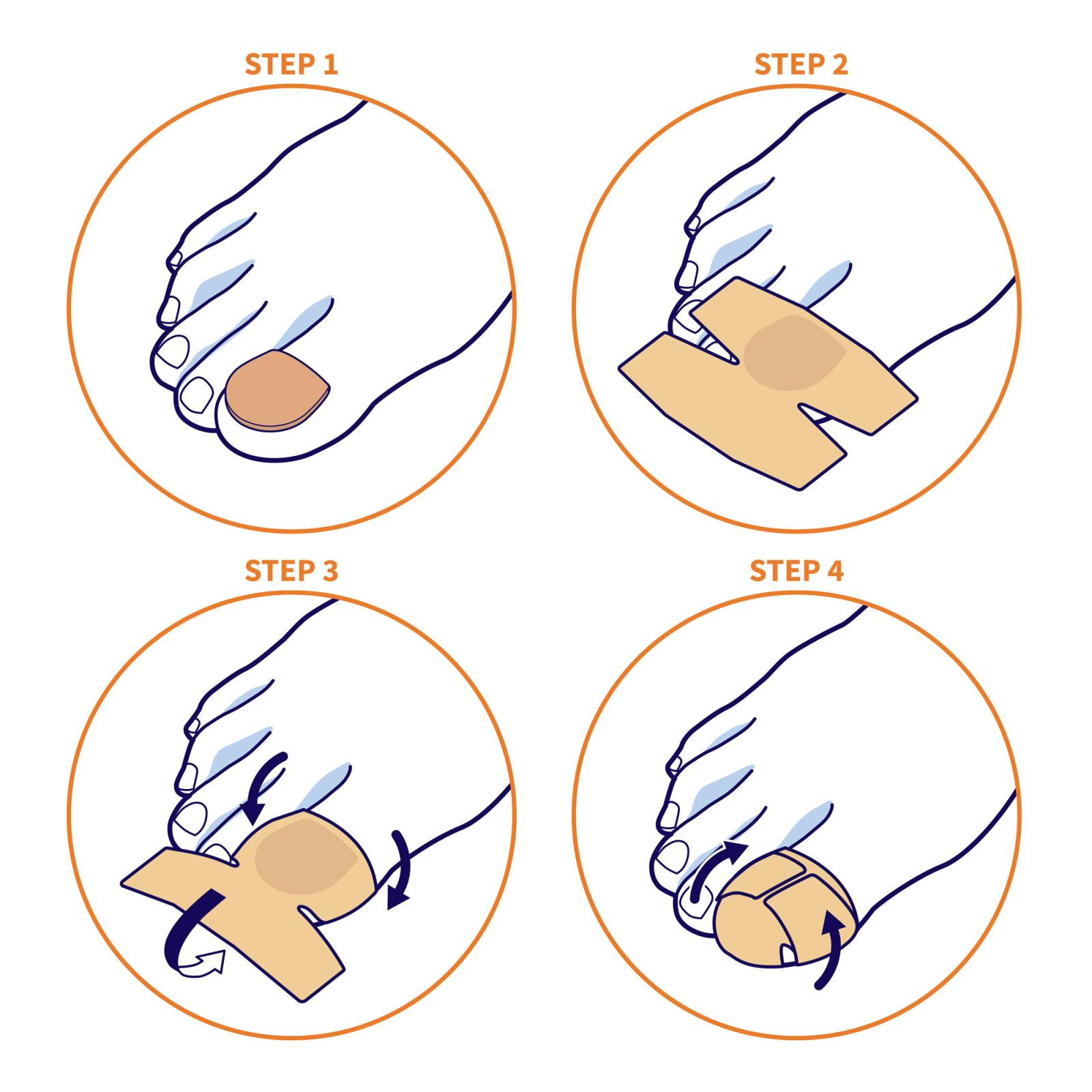 Emplâtres antifongiques pour ongles des mains et des pieds avec 40% d'Urée 12 pc