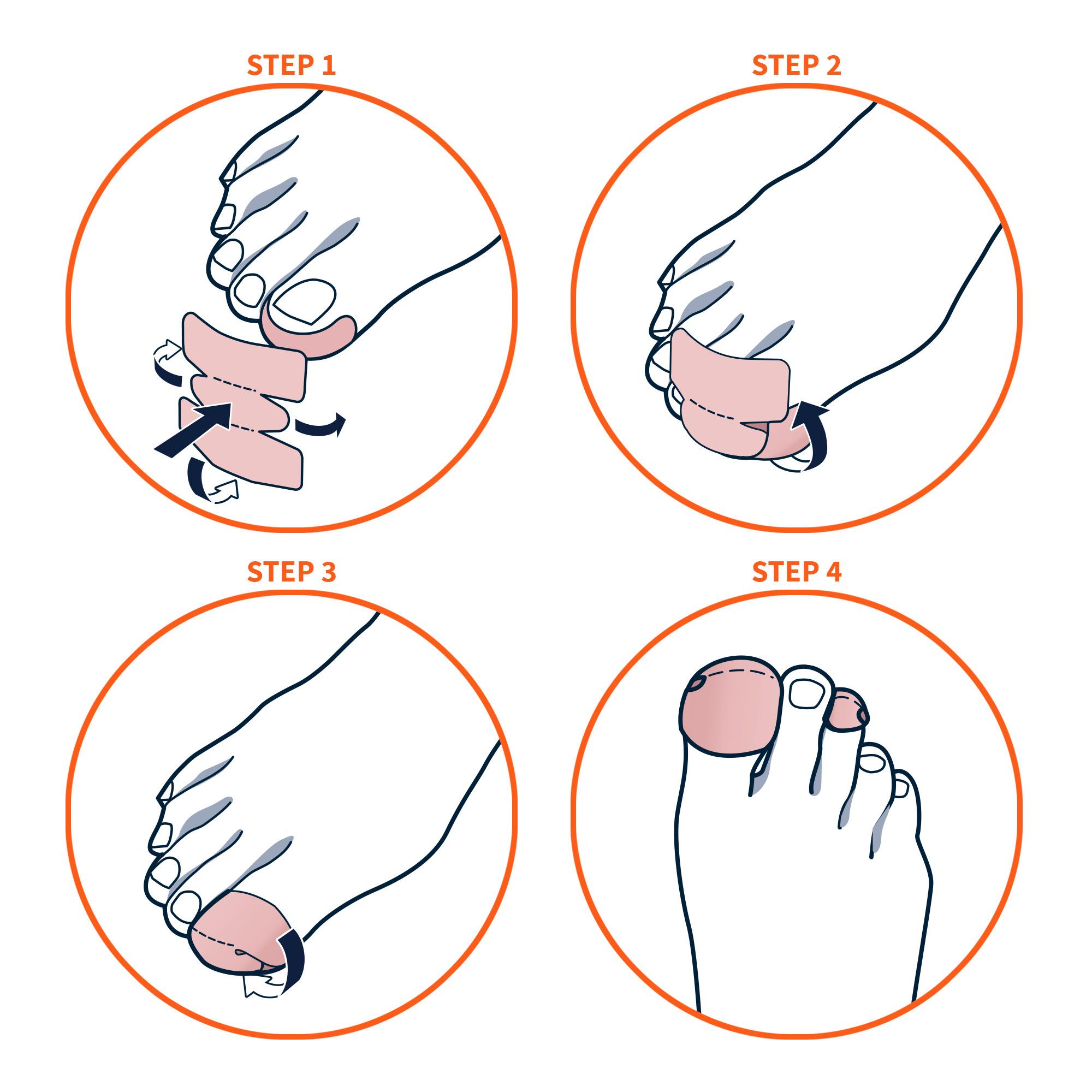 Capuchas protectoras para los dedos, para prevenir lesiones y ampollas, 4 unidades