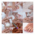 Sistema completo di graffe attive Podofix Set