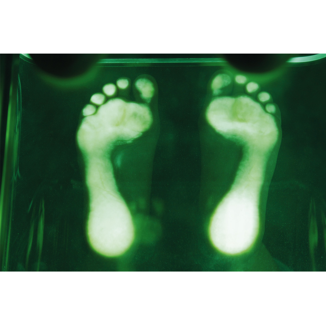 Polarised LED light methacrylate podoscope for footprint analysis