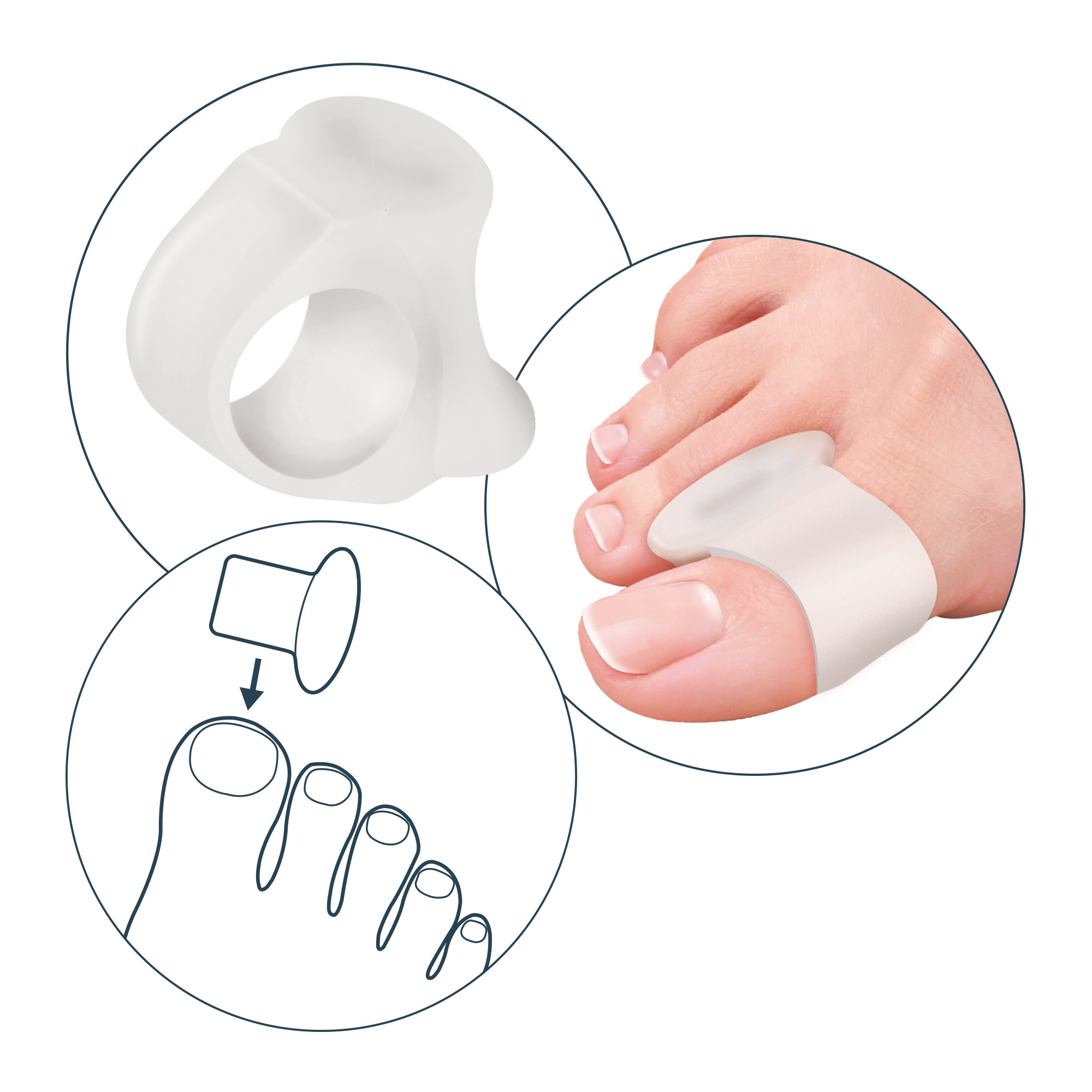 Alluxcare big toe separator and gel ring 1 pc