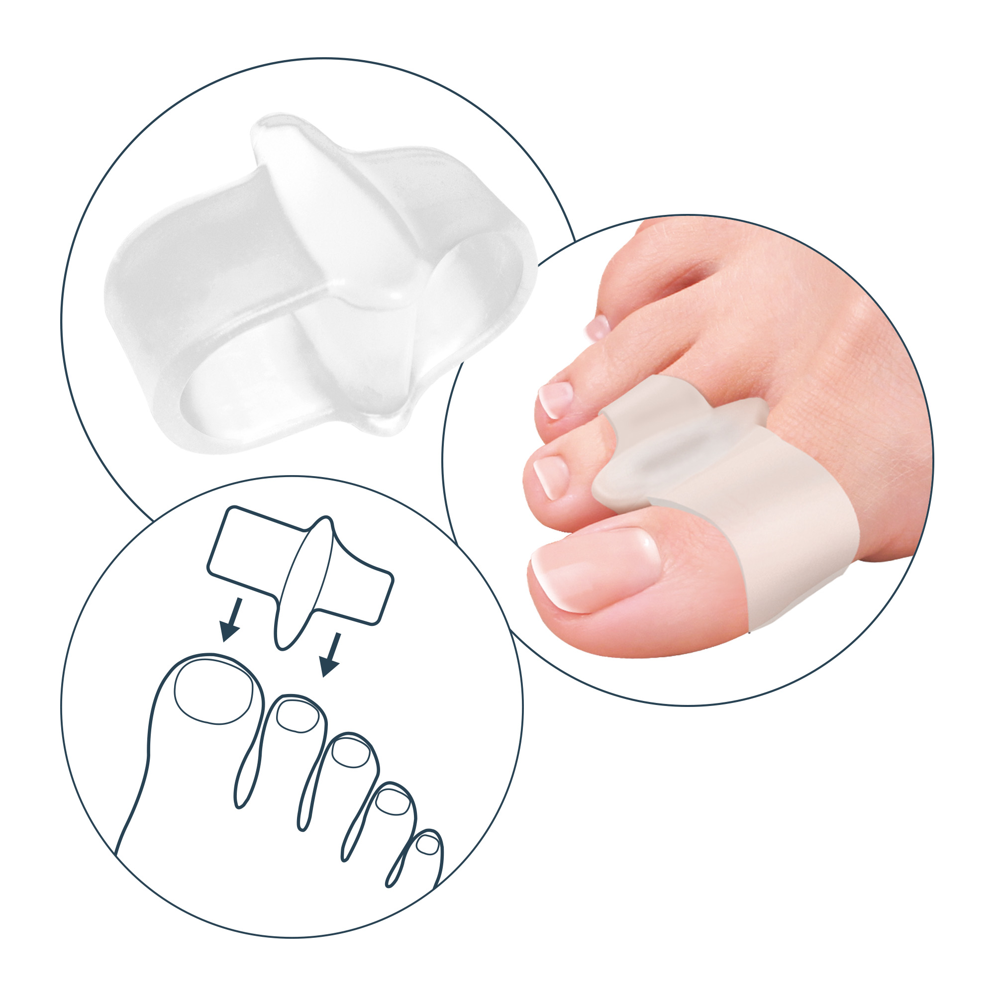 Alluxcare double ring gel toe separator and spreader 1 pc