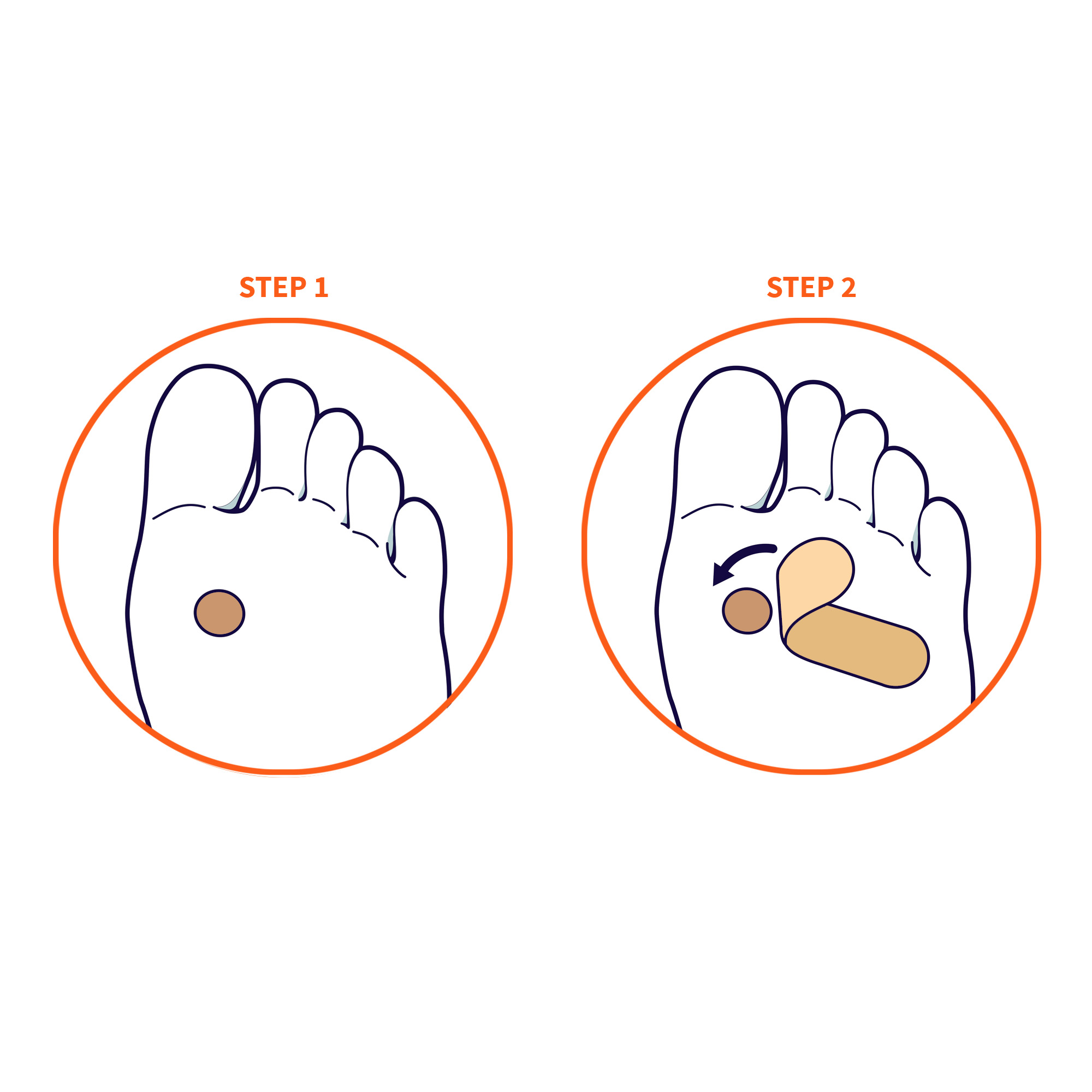 Patchs anti-verrues pour les mains et les pieds, contenant 40 % d