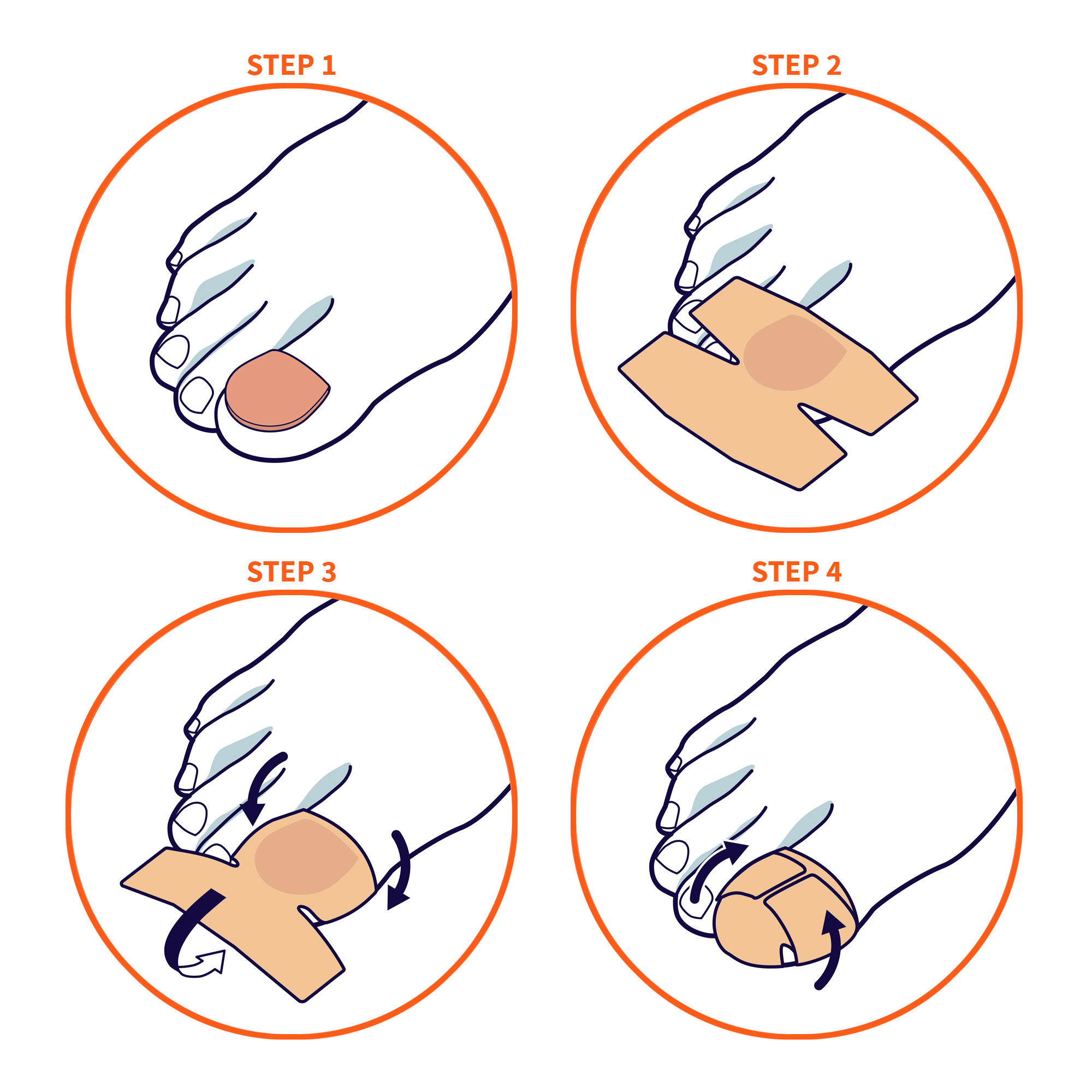 Emplâtres antifongiques pour ongles des mains et des pieds avec 40% d